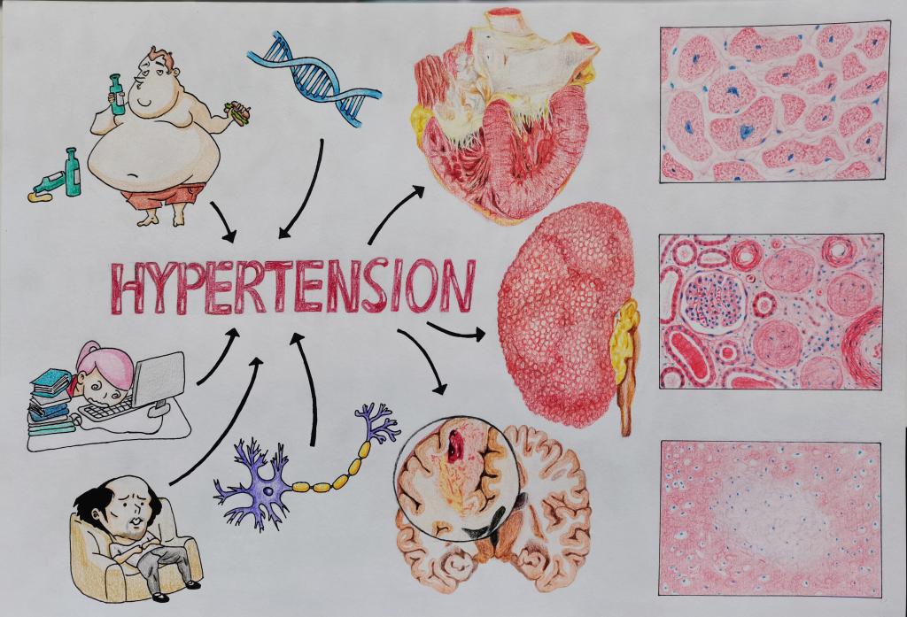 1. 邮寄手绘 作品分类 2 高血压的“前因后果” 91国产自拍
 鲁逸名